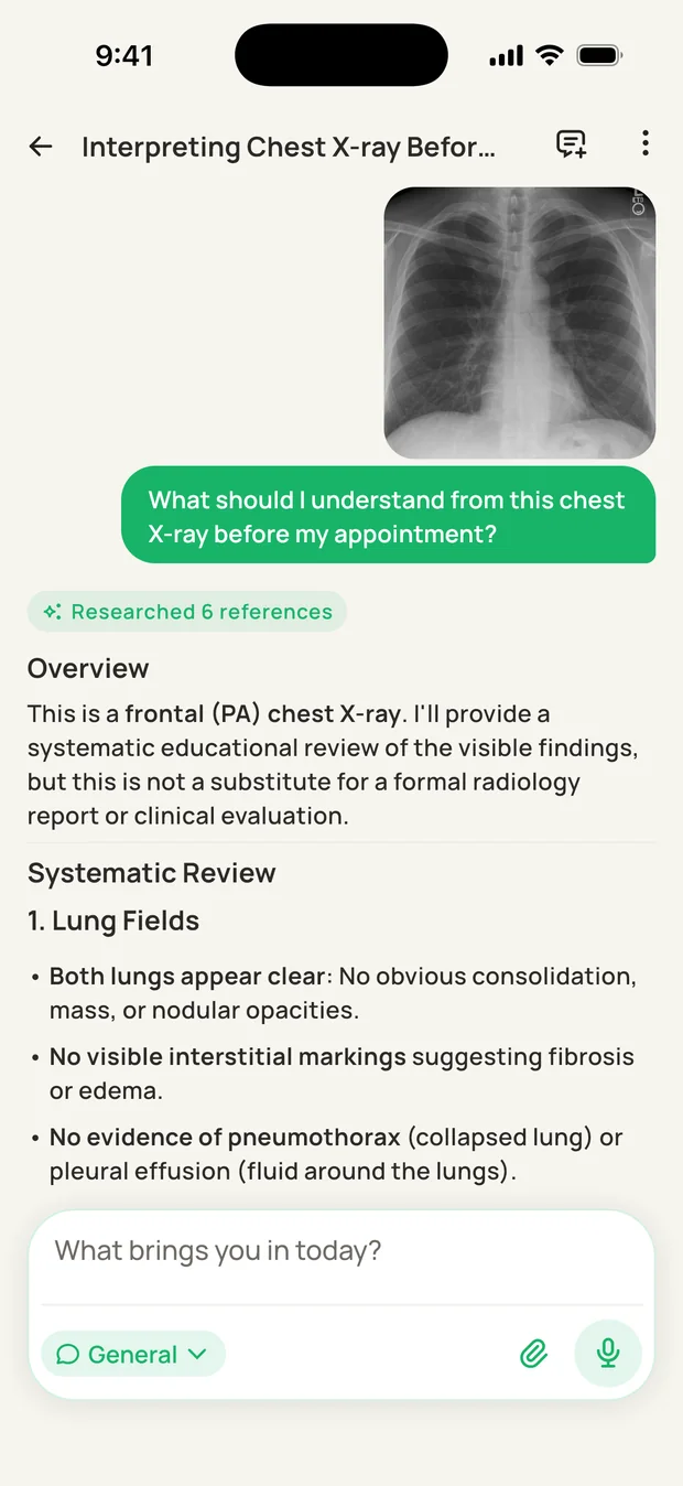A chest X-ray reviewed systematically, starting with the lung fields.